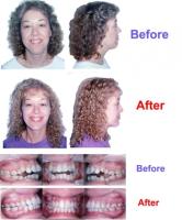 Stoner Orthodontics image 7